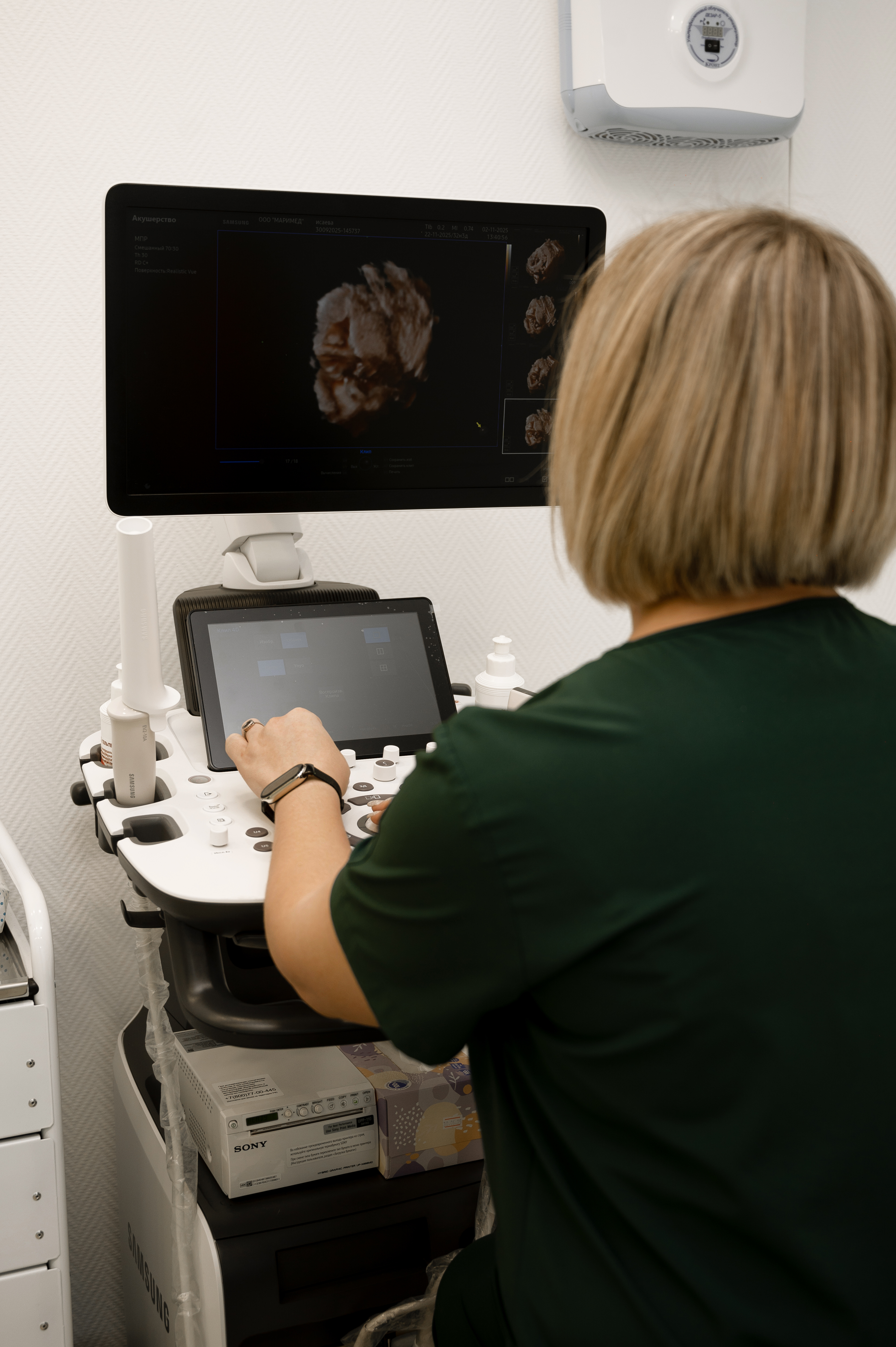 УЗИ органов малого таза